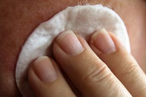 face treatment